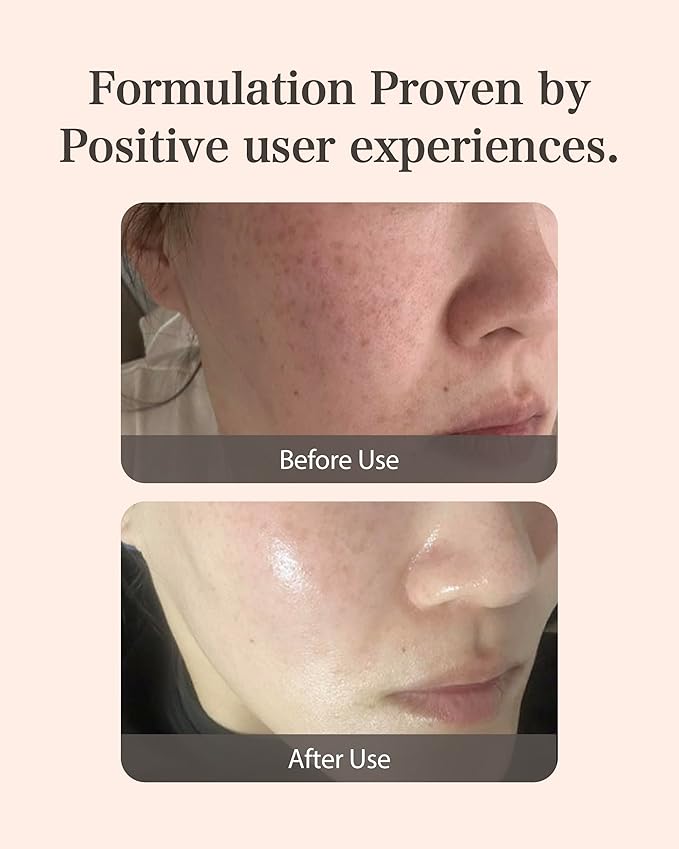 Mastina Mastic Ampoule (Dropper Type, 0.5fl oz) - Face Serum Fermented Mastic Gum. White Mastic Complex 63% + Tranexamic Acid 2% + Niacinamide 5%