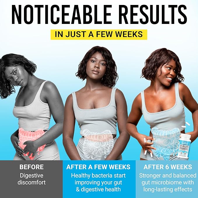 BIGJOHNLAB® Probiotics 60 Billion CFU – 10 Strains + Organic Prebiotics – Immune, Digestive & Gut Health – Supports Occasional Constipation, Diarrhea, Gas & Bloating – for Women & Men – 30ct